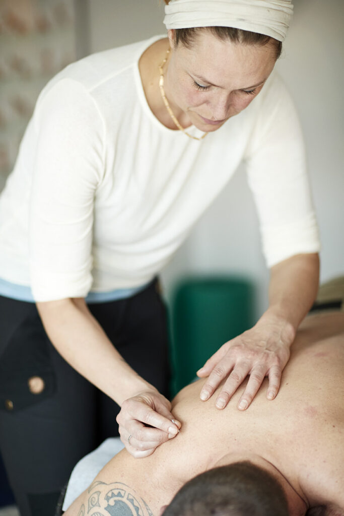 Akupunktur i Bjøreng Klinik i Århus