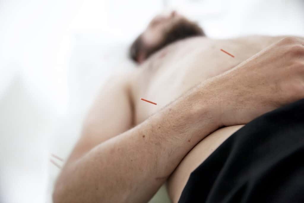 Fertilitet og akupunktur for mænd