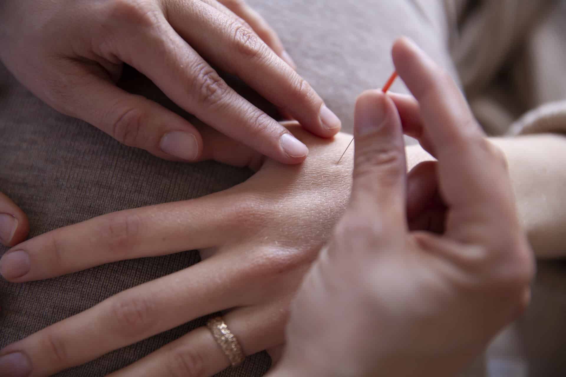 Styrk din fertilitet med akupunktur mod barnløshed