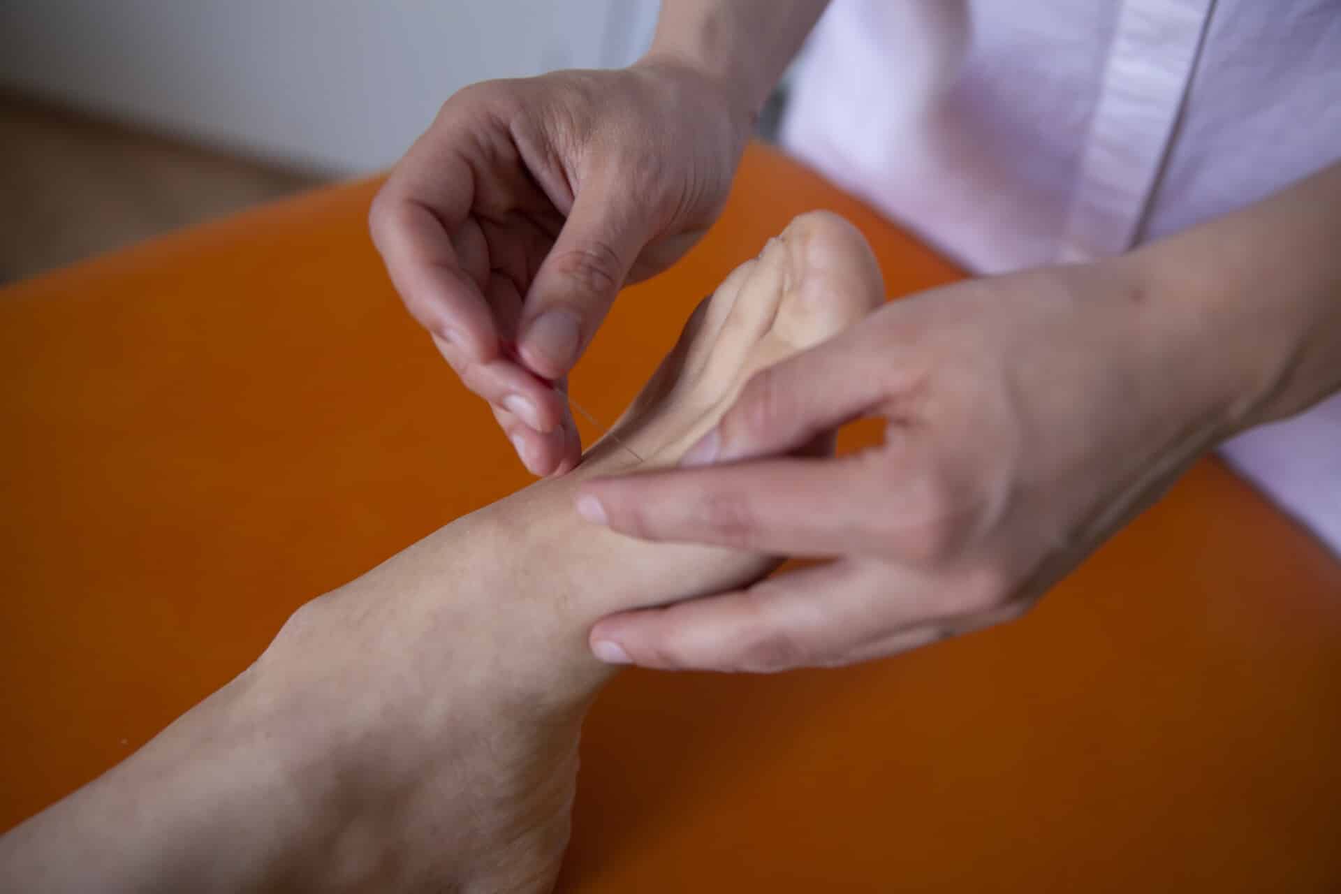 Akupunktur hos Bjøreng Klinik i Århus - virksomhedsaftale